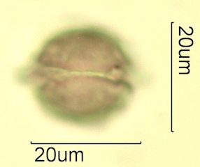 Cat's Claw Honey Pollen Under the Microscope