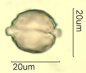 Cat's Claw Honey Pollen Under the Microscope