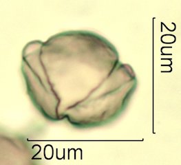 Cat's Claw Honey Pollen Under the Microscope