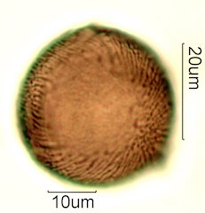 Deseret Wildflower Honey Pollen Under the Microscope