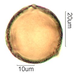 Deseret Wildflower Honey Pollen Under the Microscope