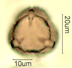 Deseret Wildflower Honey Pollen Under the Microscope