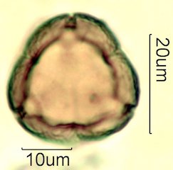 Deseret Wildflower Honey Pollen Under the Microscope