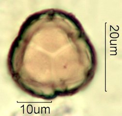 Deseret Wildflower Honey Pollen Under the Microscope