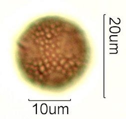 Deseret Wildflower Honey Pollen Under the Microscope