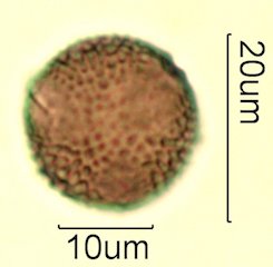 Deseret Wildflower Honey Pollen Under the Microscope