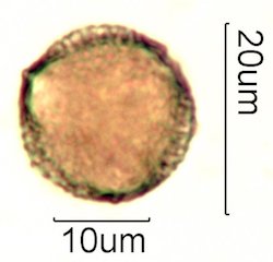 Deseret Wildflower Honey Pollen Under the Microscope