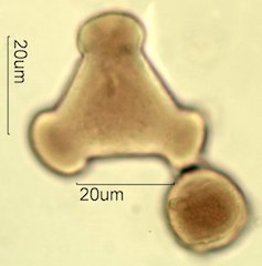 Mt. Gambel Oak Honey Pollen Under the Microscope