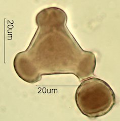 Mt. Gambel Oak Honey Pollen Under the Microscope