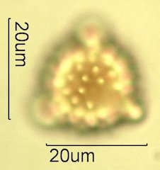Mt. Gambel Oak Honey Pollen Under the Microscope