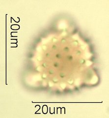 Mt. Gambel Oak Honey Pollen Under the Microscope