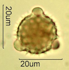 Mt. Gambel Oak Honey Pollen Under the Microscope