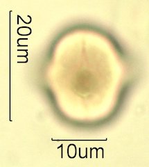 Mt. Gambel Oak Honey Pollen Under the Microscope