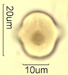 Mt. Gambel Oak Honey Pollen Under the Microscope