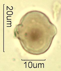 Mt. Gambel Oak Honey Pollen Under the Microscope