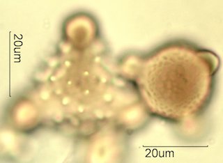 Mt. Gambel Oak Honey Pollen Under the Microscope