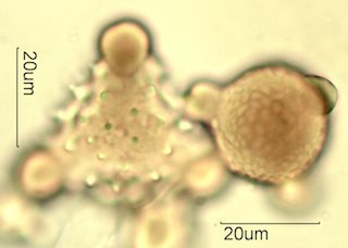 Mt. Gambel Oak Honey Pollen Under the Microscope