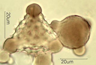 Mt. Gambel Oak Honey Pollen Under the Microscope