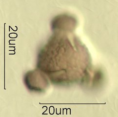 Mt. Gambel Oak Honey Pollen Under the Microscope