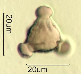 Mt. Gambel Oak Honey Pollen Under the Microscope