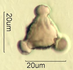 Mt. Gambel Oak Honey Pollen Under the Microscope