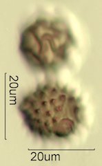Mt. Gambel Oak Honey Pollen Under the Microscope