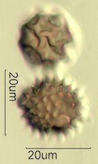 Mt. Gambel Oak Honey Pollen Under the Microscope
