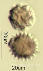 Mt. Gambel Oak Honey Pollen Under the Microscope