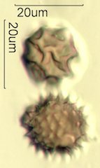 Mt. Gambel Oak Honey Pollen Under the Microscope