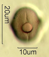 Mt. Gambel Oak Honey Pollen Under the Microscope