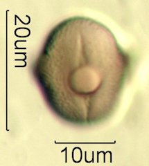 Mt. Gambel Oak Honey Pollen Under the Microscope