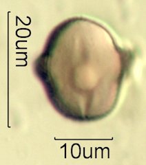 Mt. Gambel Oak Honey Pollen Under the Microscope