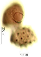 Mt. Gambel Oak Honey Pollen Under the Microscope