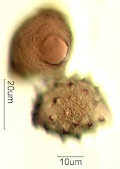 Mt. Gambel Oak Honey Pollen Under the Microscope