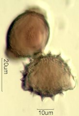 Mt. Gambel Oak Honey Pollen Under the Microscope