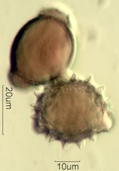 Mt. Gambel Oak Honey Pollen Under the Microscope