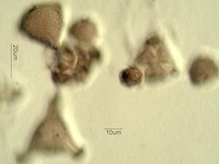 Mt. Gambel Oak Honey Pollen Under the Microscope