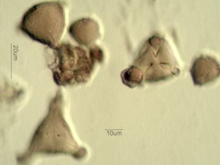 Mt. Gambel Oak Honey Pollen Under the Microscope