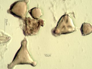 Mt. Gambel Oak Honey Pollen Under the Microscope
