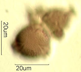 Mt. Gambel Oak Honey Pollen Under the Microscope