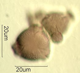 Mt. Gambel Oak Honey Pollen Under the Microscope