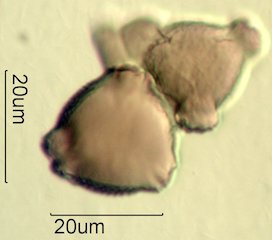 Mt. Gambel Oak Honey Pollen Under the Microscope
