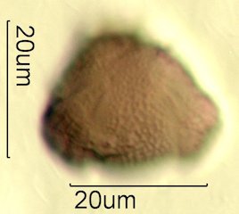 Mt. Gambel Oak Honey Pollen Under the Microscope