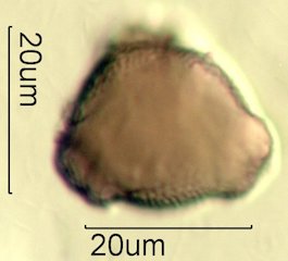 Mt. Gambel Oak Honey Pollen Under the Microscope