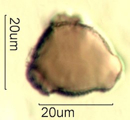 Mt. Gambel Oak Honey Pollen Under the Microscope