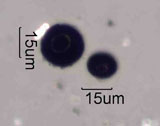 Nigrospora Spore