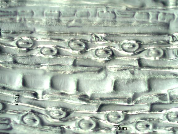 Stomata Under the Microscope
