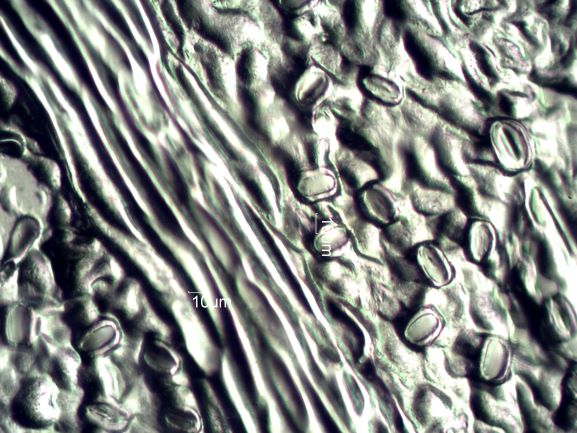 Stomata Under The Microscope