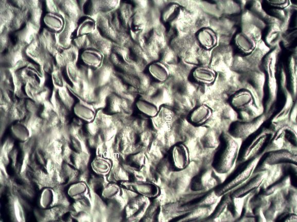 Stomata Under The Microscope