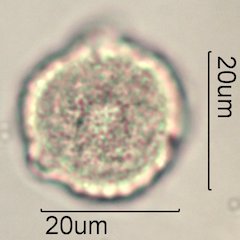 Scrub Oak (Quercus berberidifolia) Pollen under the Microscope